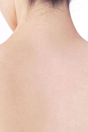 安心安全なレーザー脱毛ができる病院